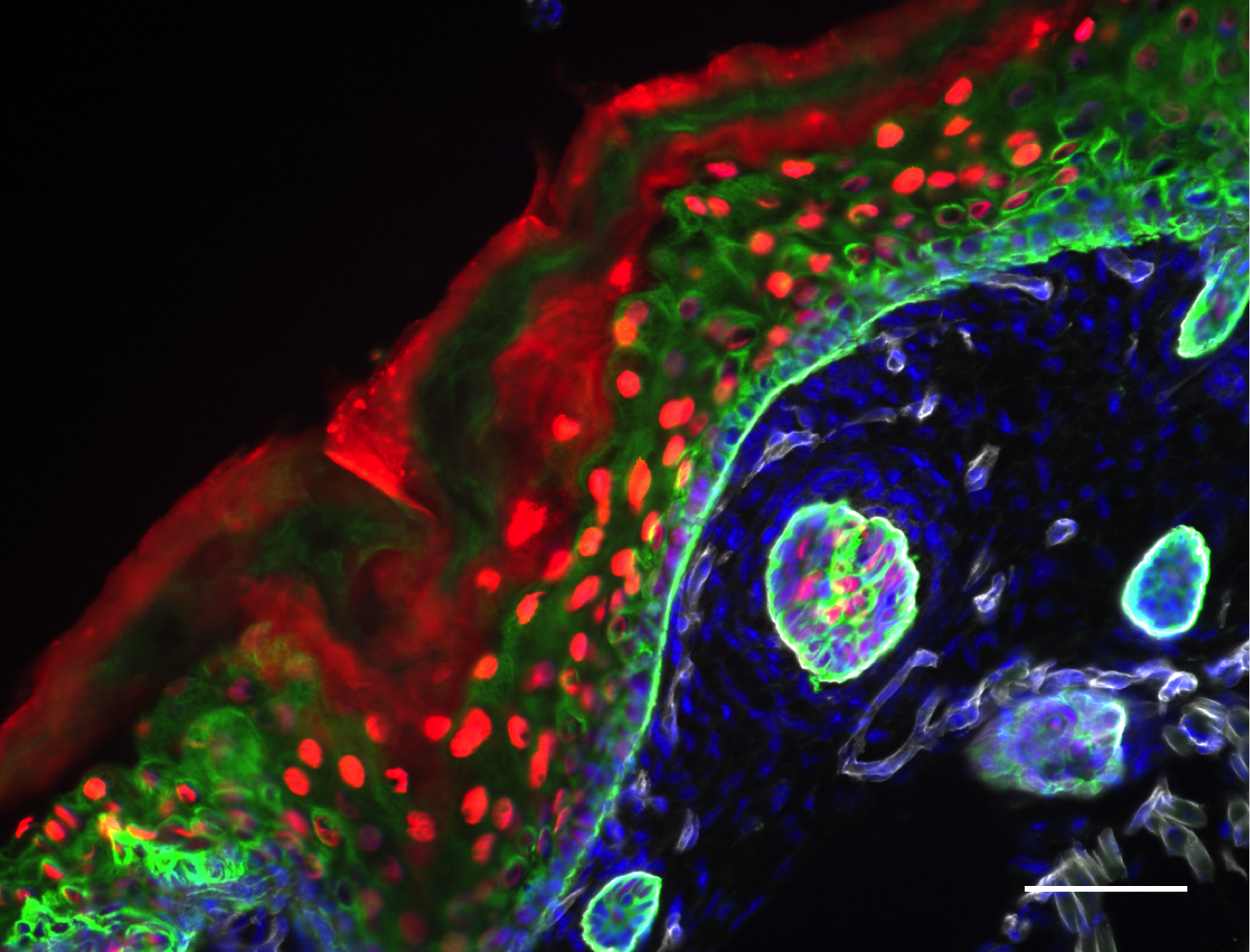 Mouse skin expressing Histone H2B-RFP
