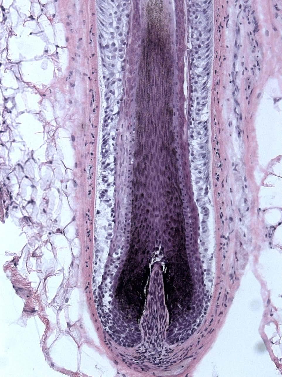 Human anagen HF stained with hematoxylin and eosin for morphology